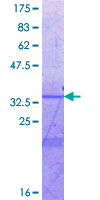 FMO4 Protein - 12.5% SDS-PAGE Stained with Coomassie Blue.
