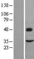 FMOD / Fibromodulin Protein - Western validation with an anti-DDK antibody * L: Control HEK293 lysate R: Over-expression lysate
