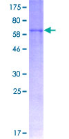 FMOD / Fibromodulin Protein - 12.5% SDS-PAGE of human FMOD stained with Coomassie Blue