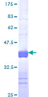 FMR1 / FMRP Protein - 12.5% SDS-PAGE Stained with Coomassie Blue.