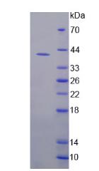 FMR1 / FMRP Protein - Recombinant  Fragile X Mental Retardation 1 By SDS-PAGE