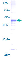FMR1NB Protein - 12.5% SDS-PAGE of human FMR1NB stained with Coomassie Blue