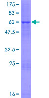 FN3K / Fructosamine-3-Kinase Protein - 12.5% SDS-PAGE of human FN3K stained with Coomassie Blue