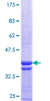 FN3K / Fructosamine-3-Kinase Protein - 12.5% SDS-PAGE Stained with Coomassie Blue.