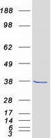 FN3K / Fructosamine-3-Kinase Protein - Purified recombinant protein FN3K was analyzed by SDS-PAGE gel and Coomassie Blue Staining