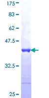 FNDC4 Protein - 12.5% SDS-PAGE Stained with Coomassie Blue.