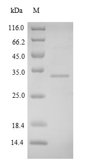 FNDC5 / Irisin Protein - (Tris-Glycine gel) Discontinuous SDS-PAGE (reduced) with 5% enrichment gel and 15% separation gel.