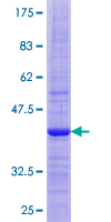 FNDC5 / Irisin Protein - 12.5% SDS-PAGE of human FNDC5 stained with Coomassie Blue