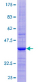 FNDC5 / Irisin Protein - 12.5% SDS-PAGE of human FNDC5 stained with Coomassie Blue