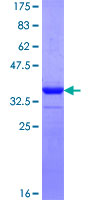 FNDC5 / Irisin Protein - 12.5% SDS-PAGE Stained with Coomassie Blue.
