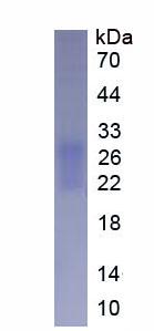 FNDC5 / Irisin Protein - Active Fibronectin Type III Domain Containing Protein 5 (FNDC5) by SDS-PAGE