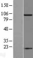 FOLH1 / PSMA Protein - Western validation with an anti-DDK antibody * L: Control HEK293 lysate R: Over-expression lysate