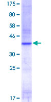 FOLH1 / PSMA Protein - 12.5% SDS-PAGE Stained with Coomassie Blue.