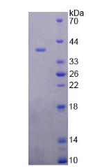 FOLH1 / PSMA Protein - Recombinant  Glutamate Carboxypeptidase II By SDS-PAGE