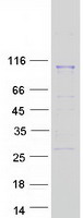 FOLH1 / PSMA Protein - Purified recombinant protein FOLH1 was analyzed by SDS-PAGE gel and Coomassie Blue Staining