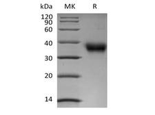 FOLR1 / Folate Receptor Alpha Protein - Recombinant Human Folate Receptor alpha/FOLR1 (C-6His-Avi) Biotinylated