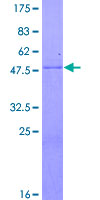 FOLR1 / Folate Receptor Alpha Protein - 12.5% SDS-PAGE of human FOLR1 stained with Coomassie Blue
