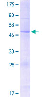 FOLR3 Protein - 12.5% SDS-PAGE of human FOLR3 stained with Coomassie Blue