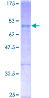 FOS / c-FOS Protein - 12.5% SDS-PAGE of human FOS stained with Coomassie Blue