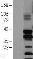 FOSB Protein - Western validation with an anti-DDK antibody * L: Control HEK293 lysate R: Over-expression lysate