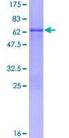 FOSB Protein - 12.5% SDS-PAGE of human FOSB stained with Coomassie Blue