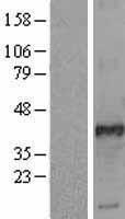 FOSL2 / FRA-2 Protein - Western validation with an anti-DDK antibody * L: Control HEK293 lysate R: Over-expression lysate