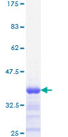 FOSL2 / FRA-2 Protein - 12.5% SDS-PAGE Stained with Coomassie Blue.