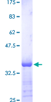 FOXA1 Protein - 12.5% SDS-PAGE Stained with Coomassie Blue.