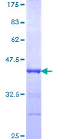 FOXA1 Protein - 12.5% SDS-PAGE Stained with Coomassie Blue.