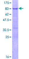 FOXA1 Protein - 12.5% SDS-PAGE of human FOXA1 stained with Coomassie Blue
