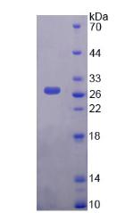 FOXA1 Protein - Recombinant  Forkhead Box Protein A1 By SDS-PAGE