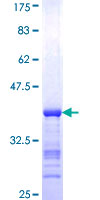 FOXA2 Protein - 12.5% SDS-PAGE Stained with Coomassie Blue.