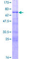 FOXA3 Protein - 12.5% SDS-PAGE of human FOXA3 stained with Coomassie Blue