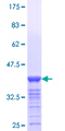FOXA3 Protein - 12.5% SDS-PAGE Stained with Coomassie Blue.