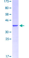 FOXC1 Protein - 12.5% SDS-PAGE Stained with Coomassie Blue.