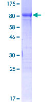 FOXC2 Protein - 12.5% SDS-PAGE of human FOXC2 stained with Coomassie Blue