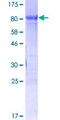 FOXC2 Protein - 12.5% SDS-PAGE of human FOXC2 stained with Coomassie Blue