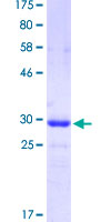 FOXC2 Protein - 12.5% SDS-PAGE Stained with Coomassie Blue.