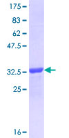 FOXD2 Protein - 12.5% SDS-PAGE Stained with Coomassie Blue.