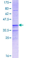 FOXD4L4 Protein - 12.5% SDS-PAGE Stained with Coomassie Blue.