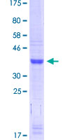 FOXF1 Protein - 12.5% SDS-PAGE Stained with Coomassie Blue.