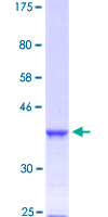 FOXF2 Protein - 12.5% SDS-PAGE Stained with Coomassie Blue.