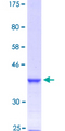 FOXF2 Protein - 12.5% SDS-PAGE Stained with Coomassie Blue.