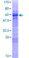 FOXI1 Protein - 12.5% SDS-PAGE of human FOXI1 stained with Coomassie Blue