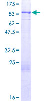 FOXJ2 Protein - 12.5% SDS-PAGE of human FOXJ2 stained with Coomassie Blue