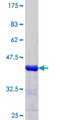 FOXJ2 Protein - 12.5% SDS-PAGE Stained with Coomassie Blue.