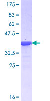 FOXK2 / ILF Protein - 12.5% SDS-PAGE Stained with Coomassie Blue.