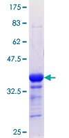 FOXL1 Protein - 12.5% SDS-PAGE Stained with Coomassie Blue.