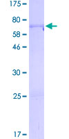 FOXL2 Protein - 12.5% SDS-PAGE of human FOXL2 stained with Coomassie Blue