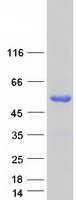 FOXL2 Protein - Purified recombinant protein FOXL2 was analyzed by SDS-PAGE gel and Coomassie Blue Staining